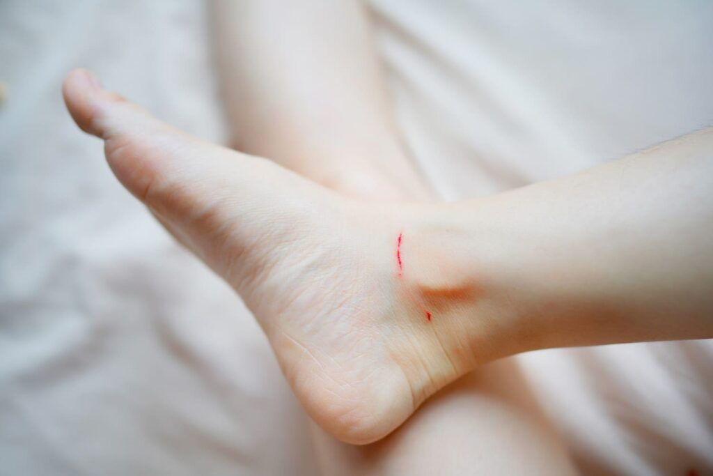 Itchy Feet Meaning at Night 9 Spiritual Meanings (Updated)